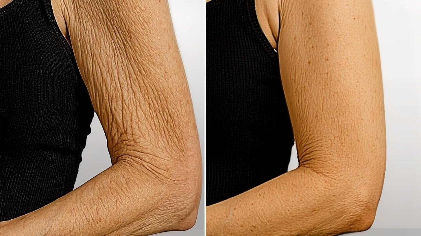 Ejemplo ilustrativo de la textura de la piel del brazo